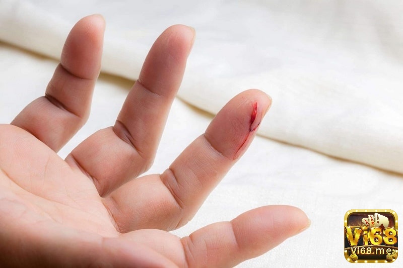 Trong dân gian vị trí chảy máu trên cơ thể có ý nghĩa quan trọng trong việc xác định con số lô đề