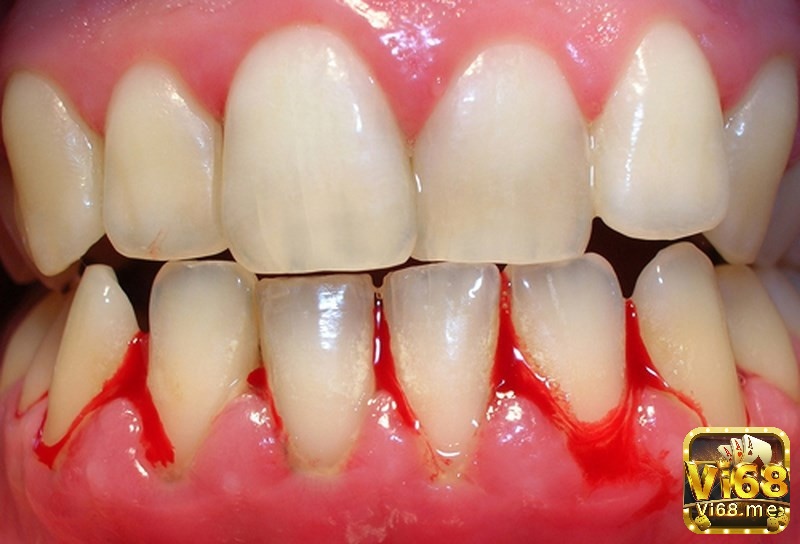 Niềm tin vào điềm báo chảy máu văn hóa dân gian lâu đời, cố gắng tìm kiếm ý nghĩa hiện tượng tự nhiên xảy ra với cơ thể